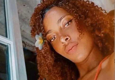 ‘Briga por causa de calcinha’: Jovem morre após ser queimada com água quente pela cunhada