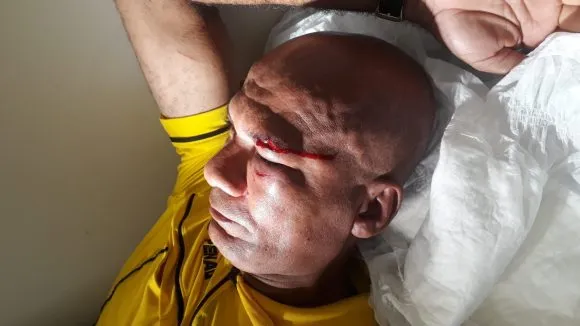 Ipiaú: Árbitro sofre agressão durante partida do campeonato da cidade no estádio Pedro Caetano