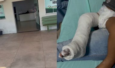Criança sofre fratura após ser atingida por estrutura provisória em hospital de Confresa